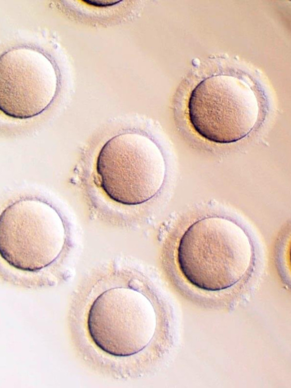 Óvulos vistos al microscopio