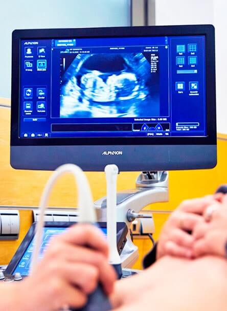 Fecundación in vitro en laboratorio IVF-Life