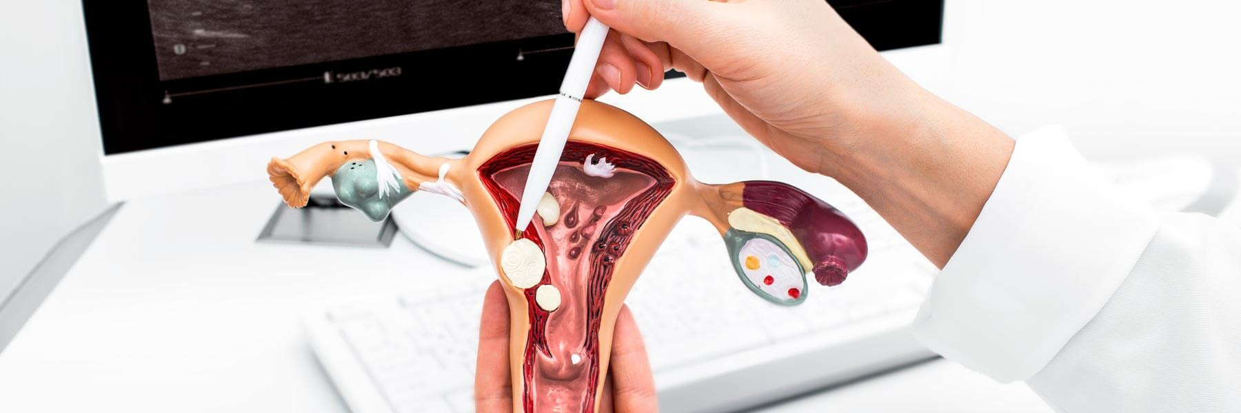 Ginekologoak endometrioko hartzailetasuna azaltzen