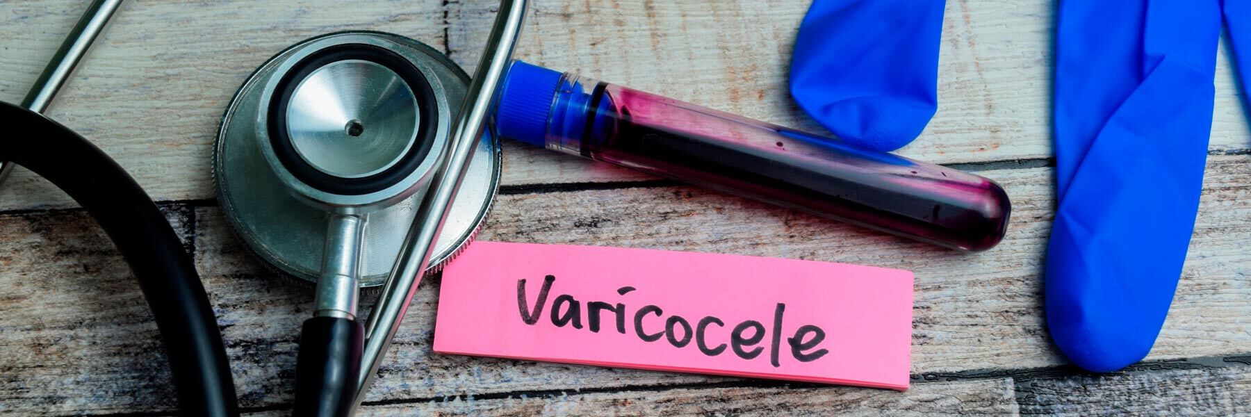 Diagnóstico del varicocele en consulta de fertilidad