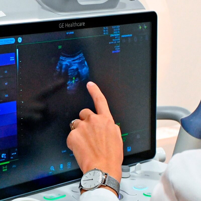 Doctora realizando ecografía para detectar la endometriosis