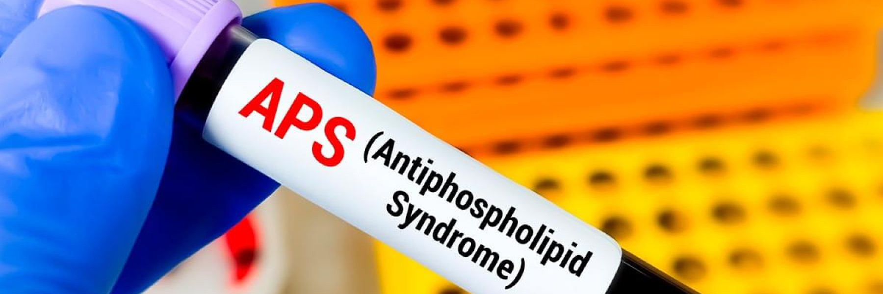 Análisis del síndrome antifosfolípido
