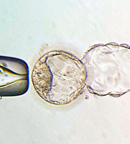 In-vitro-Fertilisation unter dem Mikroskop