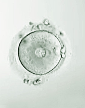 In-vitro-Fertilisations-Eizelle unter dem Mikroskop