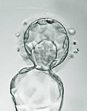 Embryo teilt sich, wie unter dem Mikroskop zu sehen.