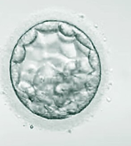 Teilung eines Embryos zur Embryonenadoption