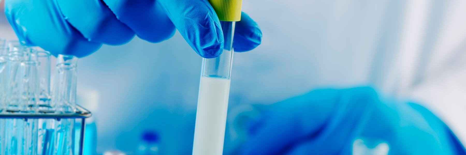 Selection of semen samples for sperm preparation