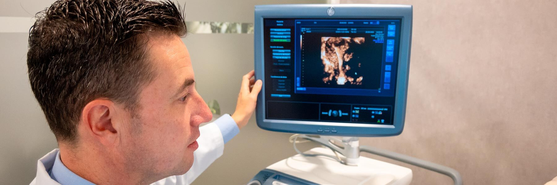 Paciente con síndrome de Asherman en consulta de IVF-Life