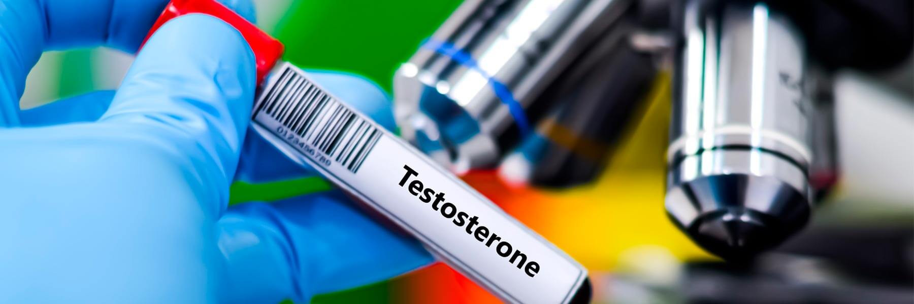 Análisis de testosterona para analizar la fertilidad masculina